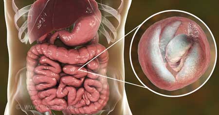 Prevalence and Determinants of Intestinal Parasitic Infections in Children from Four Cities in Kyrgyz Republic