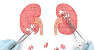 A Prospective Observational Study on Assessment of Antibiotic Therapy in Renal Failure Patients with Infections