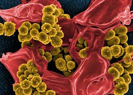 Anti-Bacterial Activity of Homoeopathic Nosodes Anthracinum, Pyrogenium and Variolinum in 30 C, 200 C and 1 M Potencies Against Methicillin Resistant Staphylococcus Aureus – An In Vitro Study